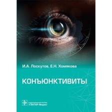 Conjunctivitis. Loskutov I.