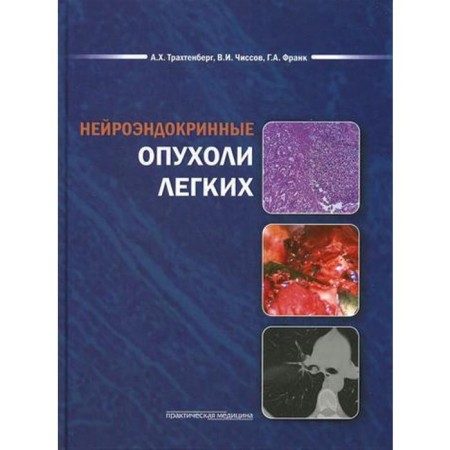 Neuroendocrine lung tumors. Trakhtenberg A.Kh.
