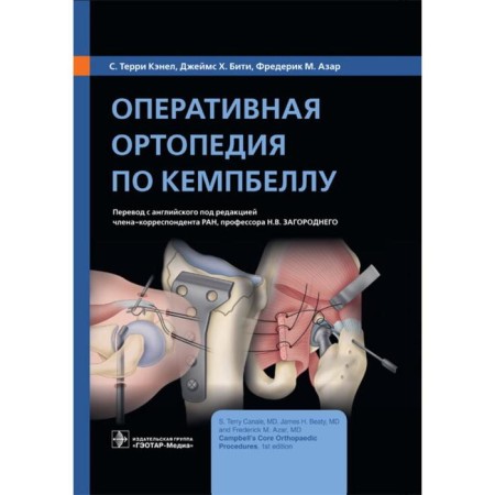 Operational orthopedics for Kempbell. Kenel, S. Terry