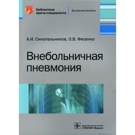 Navalic pneumonia. Sinopalnikov A.I., Fesenko O.V.