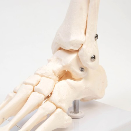 The Ikolnostopic joint layout is 25*11*11cm-3