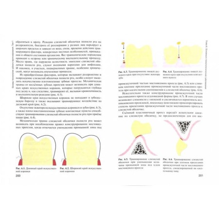 Fundamentals of dental prosthetics technology. Volume 1-1