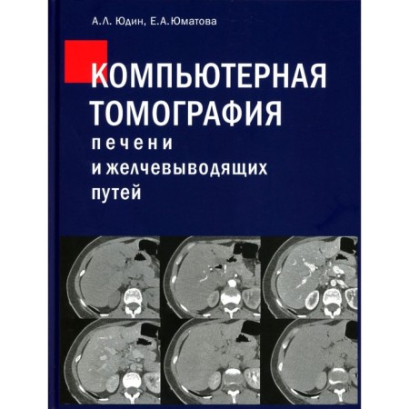 Computed tomography of the liver and biliary tract. Practical leadership. Yudin A.L., Yumatova E.A.