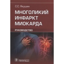 Multiple myocardial infarction: Guide. Yakushin Sergey Stepanovich