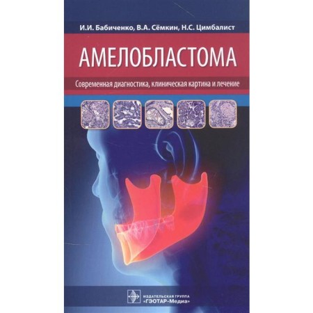 Ameloblastoma: modern diagnosis, clinical picture and treatment. Babichenko I.I.