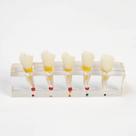 Layout "Building tooth, Diseases", 10*4*2cm-1
