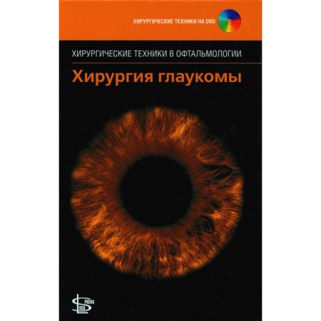 Glaucoma surgery. + DVD. Ed. Chen T.
