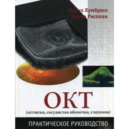 Oct (retina, vascular shell, glaucoma). Practical leadership. Lumboso B., Rispoli M.