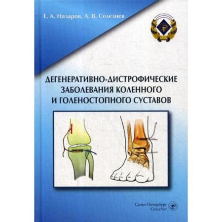 Degenerative-dystrophic diseases of the knee and ankle joints. Nazarov E.A.
