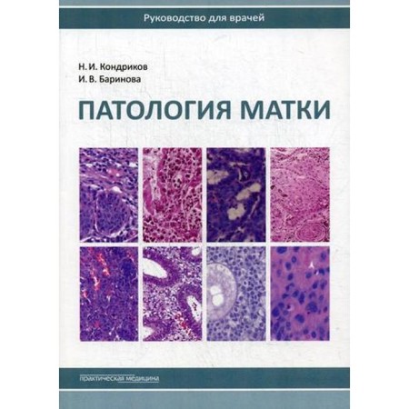 Pathology of the uterus. Guide for doctors. 2nd edition. Kondrikov N.I., Barinova I.V.