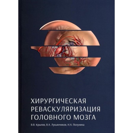 Surgical revascularization of the brain. Krylov V.V., Lukyanchikov V.A., Polunina N.A.