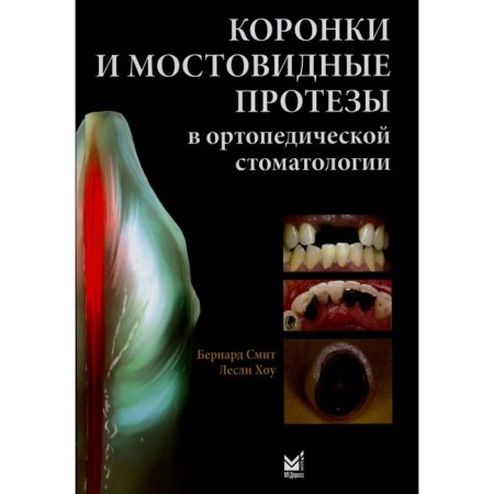 Crings and bridge prostheses in orthopedic dentistry. Smith B.