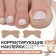 Stickers against ingrown nails, 6 pcs, 4.5 × 1.7 cm, beige color