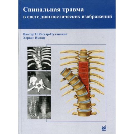 Spinal injury in the light of diagnostic images. Kassar-Pullchino V.N., IMHOF H.