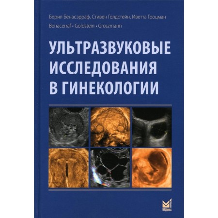 Ultrasound studies in gynecology. 2nd edition. Benaserraf B.