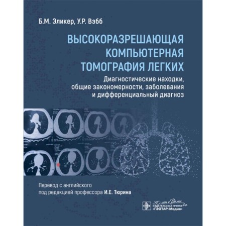 Highly resolving computed tomography of the lungs. Diagnostic finds, general patterns, diseases and differential diagnosis. ELLIER B.M., VEBB U.R.