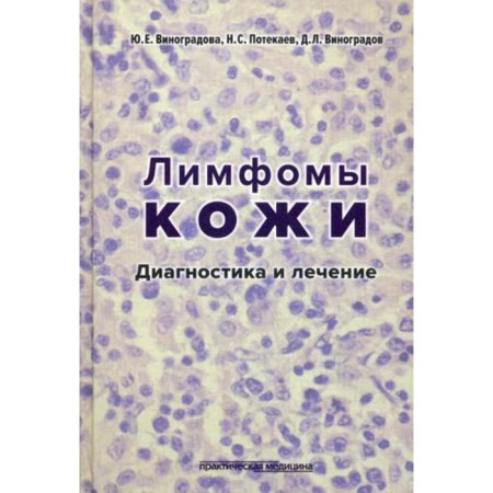Skin lymphomas: diagnosis and treatment. Vinogradova Yu.E.