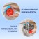 Bruste Silicone Dolyana, 2 pcs, 11 × 11 × 1 cm, color mix