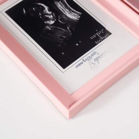 Photo frame plastic 8x12 cm "Our baby" Pink with a frame for ultrasound 2x36.5x22.7 cm-3