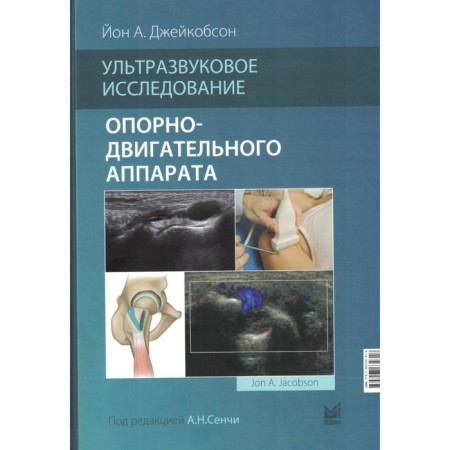Ultrasound study of the musculoskeletal system, 2nd edition. Jacobson J.A.