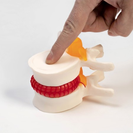 Lock "Intervertebral disc" 11*10*8cm-1