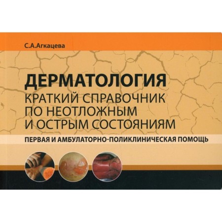 Dermatology. The first and outpatient assistance. Agrkatseva S.A.