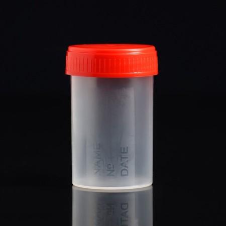A container without a spatula, sterile, in individual packaging, 60 ml-1