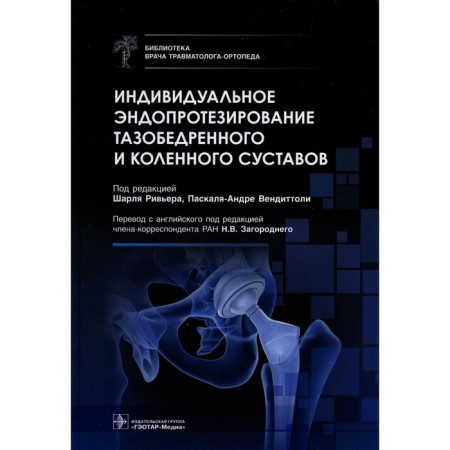 Individual endoprosthetics of the hip and knee joints