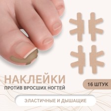 Set of stickers for correcting ingrown nails, 16 pcs, beige color