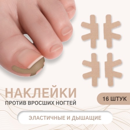 Set of stickers for correcting ingrown nails, 16 pcs, beige color
