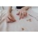 A set of plastic buttons on the leg, d = 15 mm, 10 pcs, matte, brown color