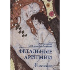 Фетальные аритмии. Стрижаков А. Н. и другие