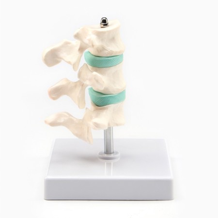 Matcage "spine in the context" 8*7cm-2