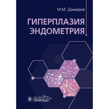 Hyperplasia of endometrium. Damirov M.M.