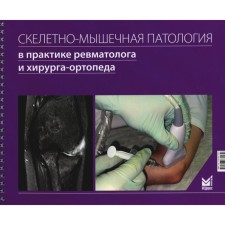 Skeletal-muscular pathology in the practice of a rheumatologist and surgeon-orthopedic. Karateev A.E., Makarov M.A., Makarov S.A.