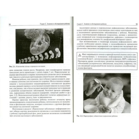Pediatrics. Disease history. Kildiyarova R., Makarova V., Fayzullina R.-3