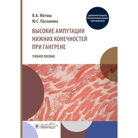 High amputations of the lower extremities with gangrene. Tutorial. Mitish V.A., Paskalova Yu.S.