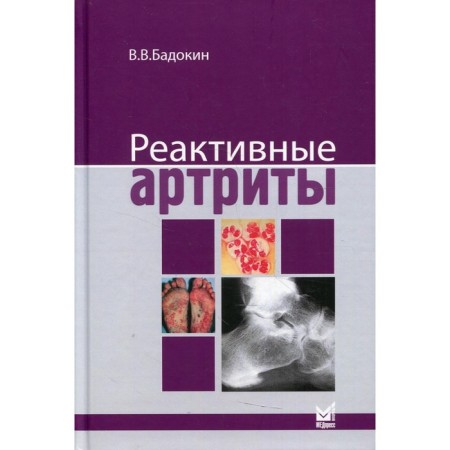 Reactive arthritis. Urogenital and post -Enterocolitic. Badokin V.V.