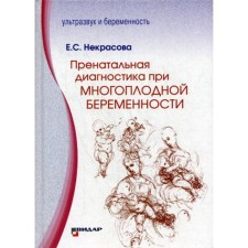 Пренатальная диагностика при многоплодной беременности. Некрасова Е.С.