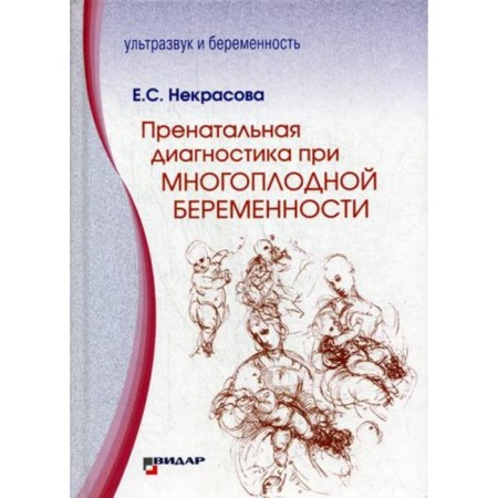 Prenatal diagnosis for multiple pregnancy. Nekrasova E.S.