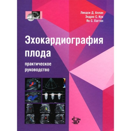 Echocardiography of the fetus. Practical leadership. + DVD. Allan L.D., Kuk E.S., Haggon Ya.S.