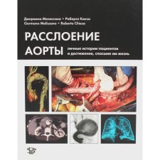 Расслоение аорты. Личные истории пациентов и достижения, спасшие им жизнь. Мелиссано Дж., Киеза Р.