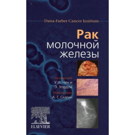Mammary cancer. Ed. Chen U.I., Wardley E.