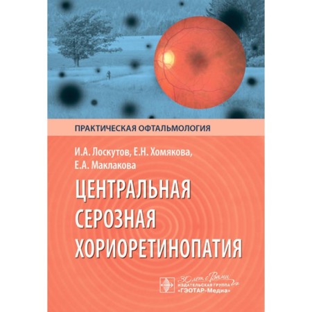 Central serous chorioretinopathy. Loskutov I.A., Khomyakova E.N., Maklakova E.A.