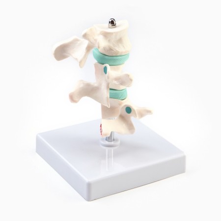 Matcage "spine in the context" 8*7cm-1