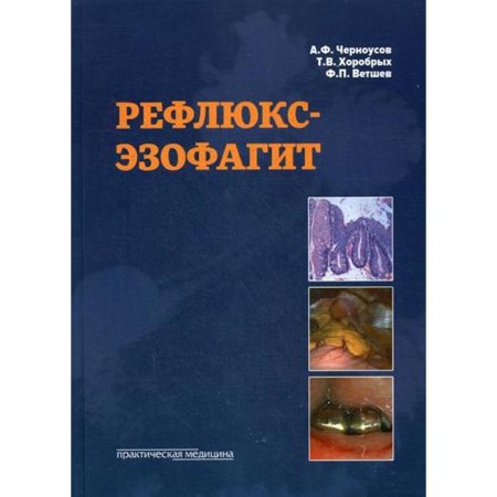 Reflux esophagitis. Chernousov A.F., Khorobrykh T.V., Vetshev F.P.