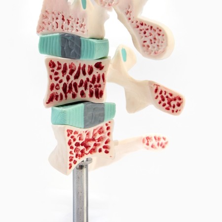 Matcage "spine in the context" 8*7cm-5