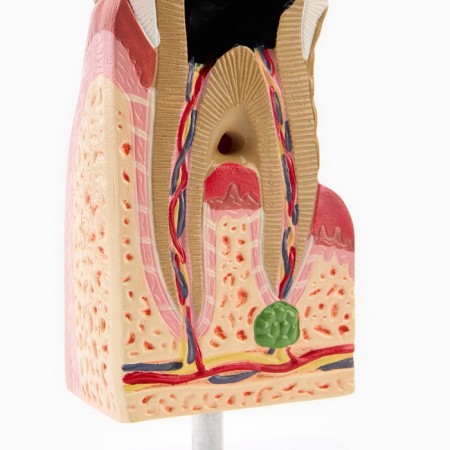 Matcage "Building tooth in the section" 13*6cm-3