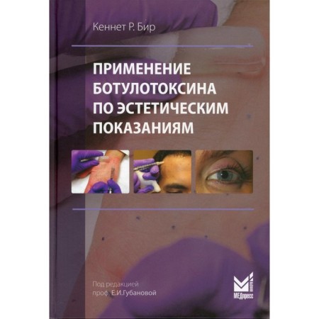 The use of botulinum toxin according to aesthetic indications. Bir K.R.