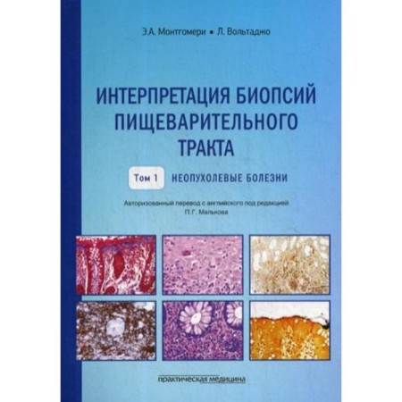 Interpretation of the digestive tract biopsy. T. 1: Non -bundle diseases. Montgomery E.A., Voltajo L.